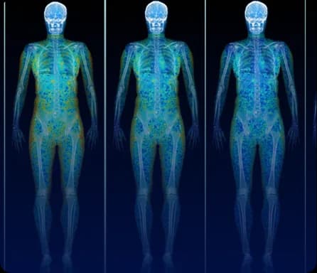 Three DEXA scan images showing fat and muscle distribution across the whole body