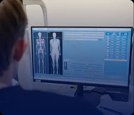 Clinician reviewing a DEXA body composition report on a monitor